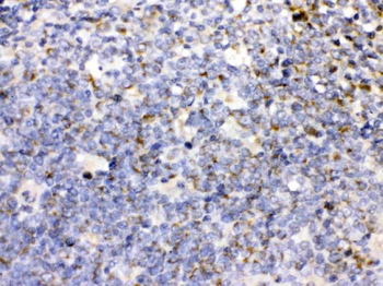 CD27 Rabbit Polyclonal Antibody