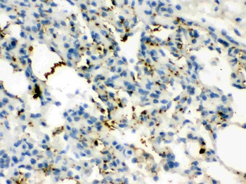 Calcitonin/CALCA Rabbit Polyclonal Antibody