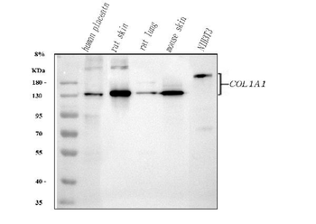 Collagen I/COL1A1 Antibody