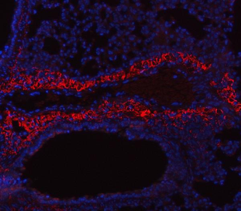 Collagen I/COL1A1 Antibody