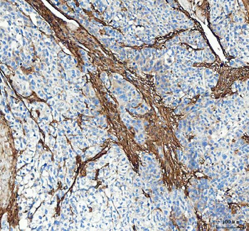 Collagen I/COL1A1 Antibody