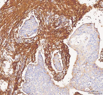 Collagen I/COL1A1 Antibody