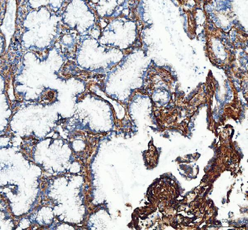 Collagen I/COL1A1 Antibody