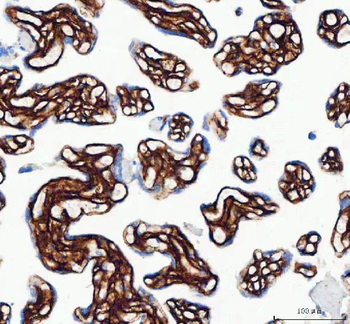 Collagen I/COL1A1 Antibody