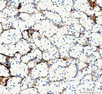 Collagen I/COL1A1 Antibody