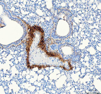 Collagen I/COL1A1 Antibody
