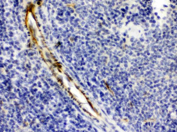 Alpha A Crystallin/CRYAA Rabbit Polyclonal Antibody