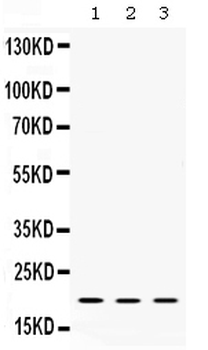 Alpha A Crystallin/CRYAA Rabbit Polyclonal Antibody
