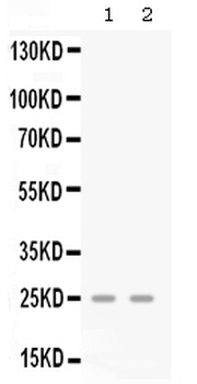GRO gamma/CXCL3 Rabbit Polyclonal Antibody