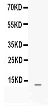 MGP Rabbit Polyclonal Antibody