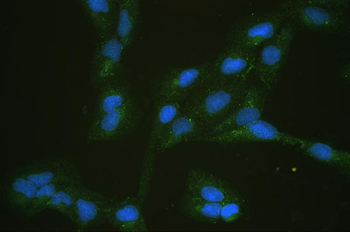 Glucose Transporter 5 GLUT5/SLC2A5 Antibody