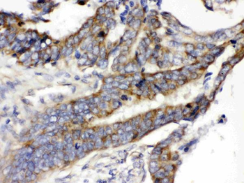 Glucose Transporter 5 GLUT5/SLC2A5 Antibody