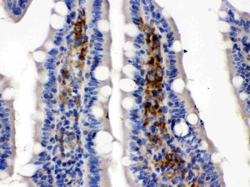 Glucose Transporter 5 GLUT5/SLC2A5 Antibody