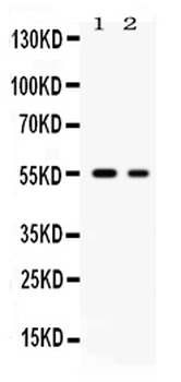 Glucose Transporter 5 GLUT5/SLC2A5 Antibody