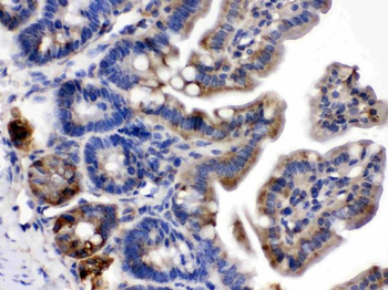 Talin 2/TLN2 Rabbit Polyclonal Antibody