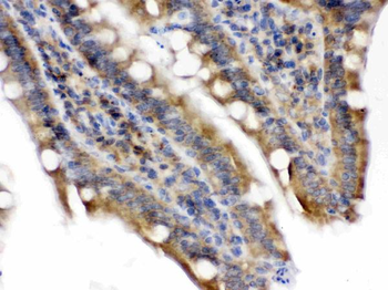 Talin 2/TLN2 Rabbit Polyclonal Antibody