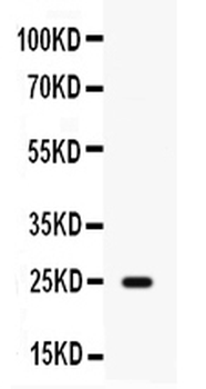 HE4/WFDC2 Antibody