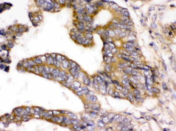 WNK1 Rabbit Polyclonal Antibody