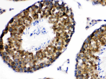 WNK1 Rabbit Polyclonal Antibody