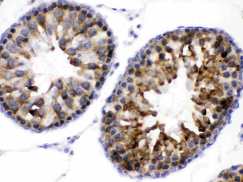 WNK1 Rabbit Polyclonal Antibody