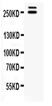 WNK1 Rabbit Polyclonal Antibody