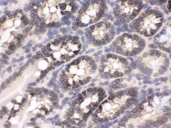 CRM1/XPO1 Antibody