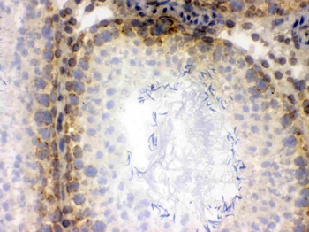 CRM1/XPO1 Antibody