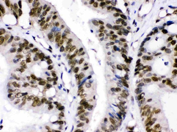 CRM1/XPO1 Antibody