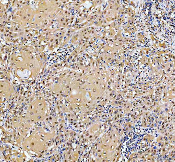 YAP1 Antibody