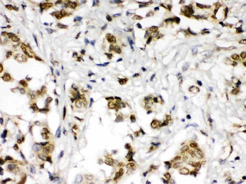 ABR Rabbit Polyclonal Antibody