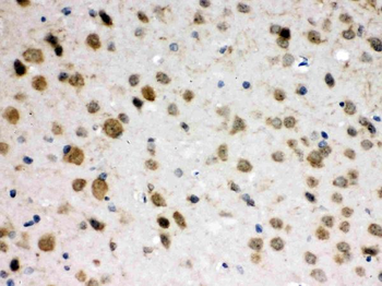ABR Rabbit Polyclonal Antibody