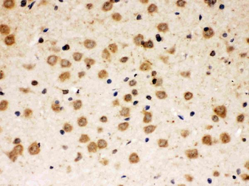 ABR Rabbit Polyclonal Antibody