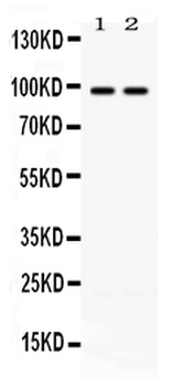 ABR Rabbit Polyclonal Antibody