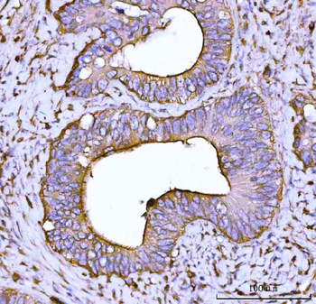 Alpha Actinin 4/ACTN4 Antibody
