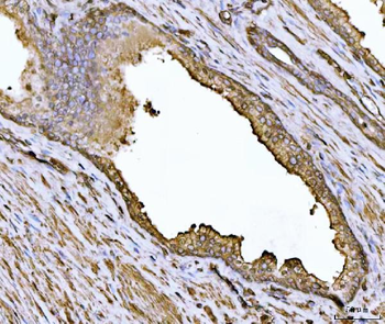 Alpha Actinin 4/ACTN4 Antibody