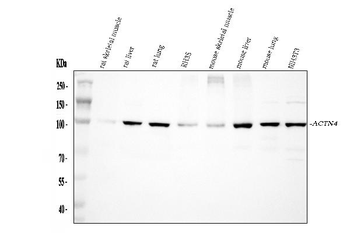 Alpha Actinin 4/ACTN4 Antibody
