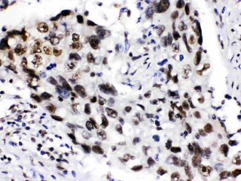 ADAR1 Rabbit Polyclonal Antibody