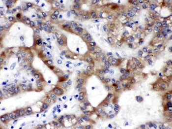 ALDH3A2 Rabbit Polyclonal Antibody