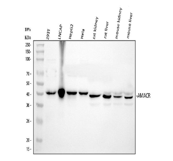 AMACR Rabbit Polyclonal Antibody