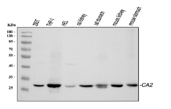 Carbonic Anhydrase II/CA2 Rabbit Polyclonal Antibody