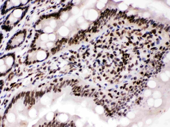 Cyclin T1/CCNT1 Rabbit Polyclonal Antibody