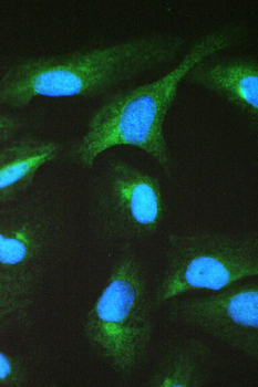 TCP1 beta/CCT2 Antibody