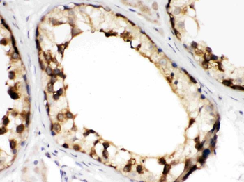 TCP1 beta/CCT2 Antibody