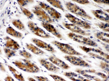 TCP1 beta/CCT2 Antibody