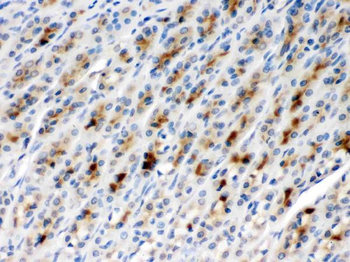 TCP1 beta/CCT2 Antibody