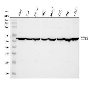 TCP1 beta/CCT2 Antibody