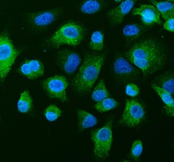 TCP1 theta/CCT8 Rabbit Polyclonal Antibody