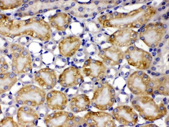 TCP1 theta/CCT8 Rabbit Polyclonal Antibody