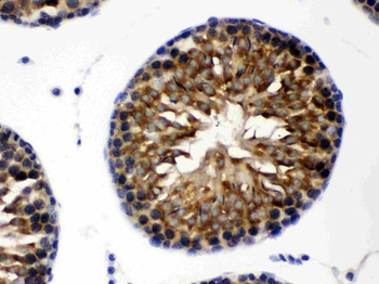 TCP1 theta/CCT8 Rabbit Polyclonal Antibody