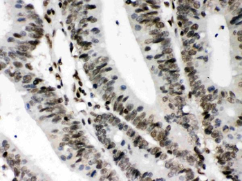 CIITA Rabbit Polyclonal Antibody